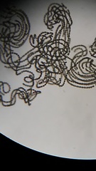 Dolichospermum