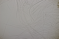 Acrospermum compressum