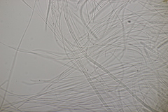 Acrospermum compressum