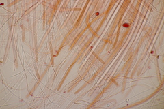 Acrospermum compressum