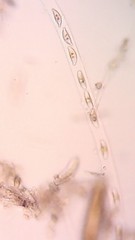 Encyonema