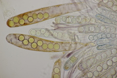 Ascobolus brassicae