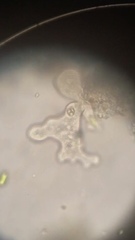 Amoeba