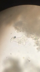 Amoeba