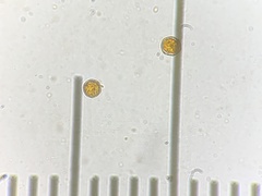 Peziza ellipsospora