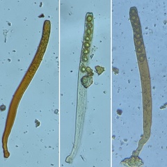 Peziza ellipsospora