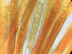 Peziza ellipsospora