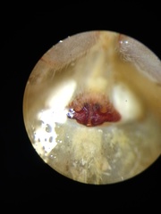 Phaeacius fimbriatus