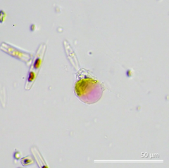 Cercozoa