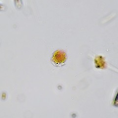 Cercozoa