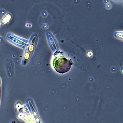 Cercozoa