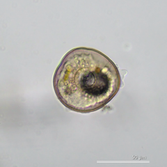 Arcella hemisphaerica