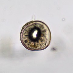 Arcella hemisphaerica