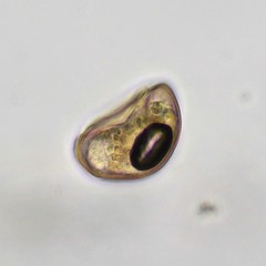 Arcella hemisphaerica