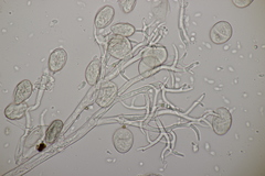Peronospora vernalis