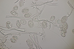 Peronospora vernalis
