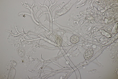 Peronospora vernalis