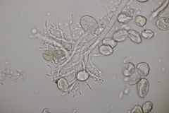 Peronospora vernalis