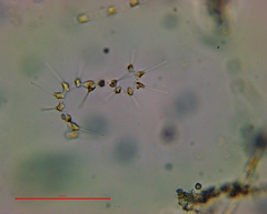 Asterionellopsis glacialis