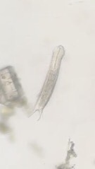 Gastrotricha