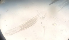 Gastrotricha