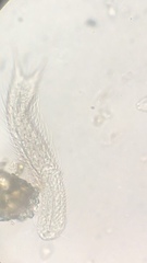 Gastrotricha