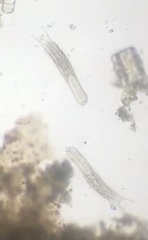 Gastrotricha