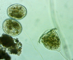 Vorticella campanula