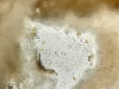 Bryoplaca sinapisperma