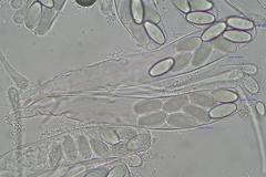 Ascobolus hawaiiensis