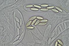 Ascobolus hawaiiensis