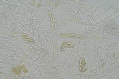 Ascobolus hawaiiensis