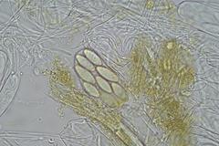 Ascobolus hawaiiensis