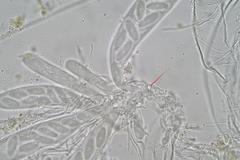 Ascobolus hawaiiensis