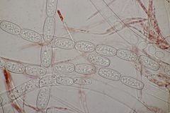 Sarcoscypha austriaca