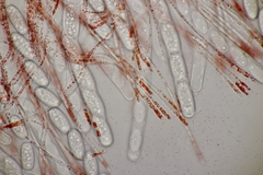 Sarcoscypha austriaca