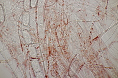 Sarcoscypha austriaca