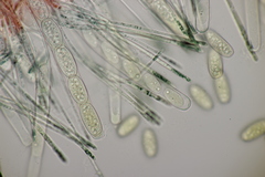 Sarcoscypha austriaca