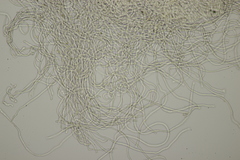 Sarcoscypha austriaca