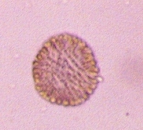 Chrysophyceae