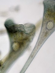 Stentor multiformis