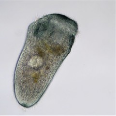 Stentor multiformis