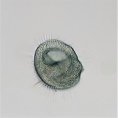 Stentor multiformis