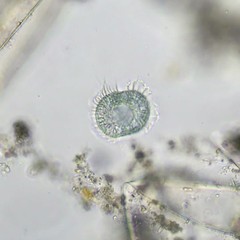 Stentor multiformis