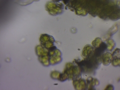 Desmococcus