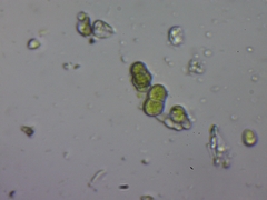 Desmococcus