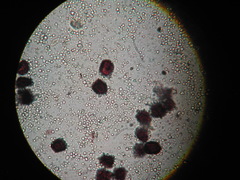 Physarum didermoides