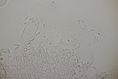 Ascozonus woolhopensis