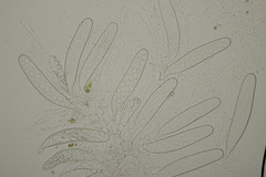 Sporormiella intermedia