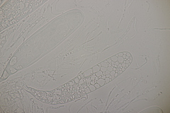 Sporormiella intermedia